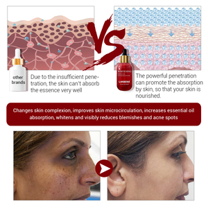 LANBENA vitis vinifera graine huile pour visage blanchissant l'essence - Product Image 2