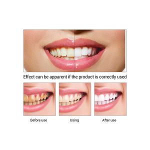 LANBENA dentaire opalescence blanchiment des dents essence livraison gratuite - Product Image 1