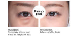 Balala mejor oferta de crema de ojos para la exportación - Product Image 4