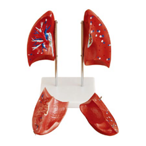 Gelsonlab HSBM-241 मानव फेफड़ों मॉडल फेफड़ों शरीर रचना विज्ञान मॉडल - Product Image 1