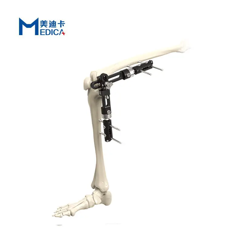Orto-fix traumatism Series extremidades inferiores articulación de la rodilla fijador externo <span class=keywords><strong>stents</strong></span> Unilateral