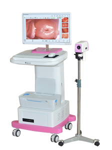 Produsen China Kolposkop Video Digital Vagina Full HD - Product Image 5