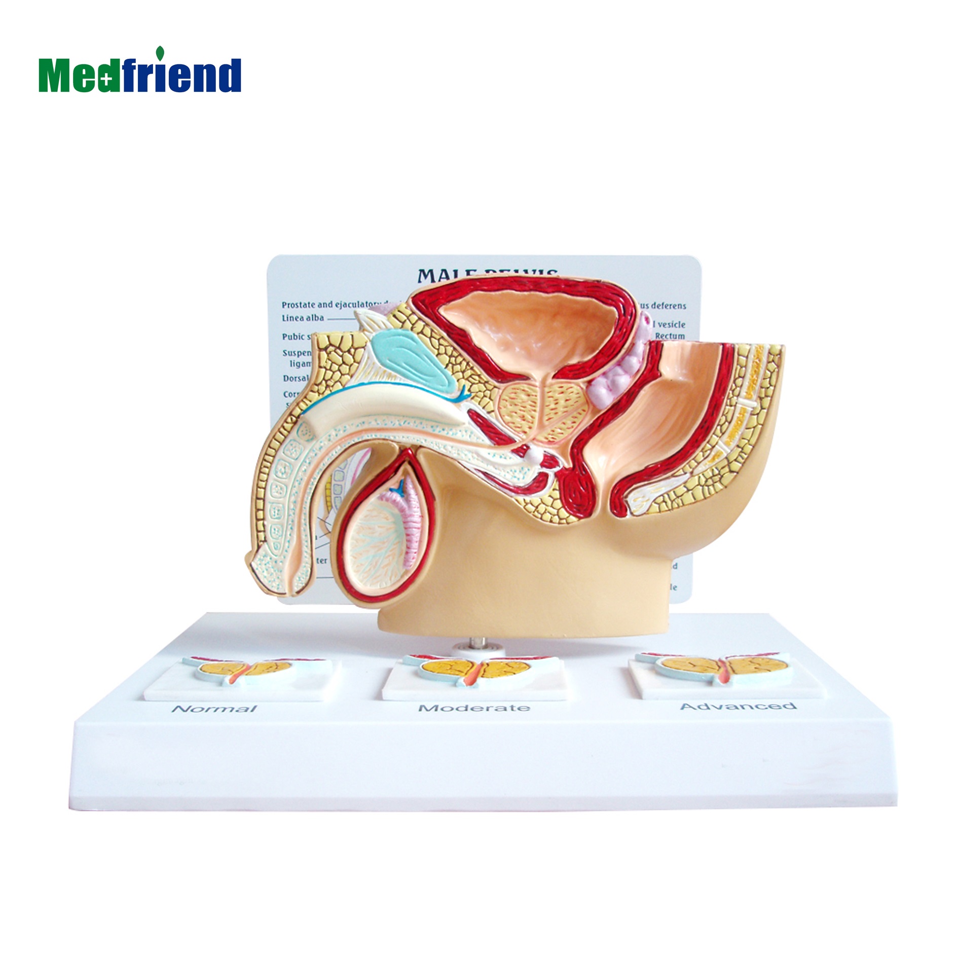 Анатомический мужской таз по заводской цене, модель простаты 3 шт.