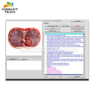 Ücretsiz kargo bioresonance medicomat <span class=keywords><strong>metatron</strong></span> 18d <span class=keywords><strong>nls</strong></span> vücut sağlığı Dedektörü - Product Image 4