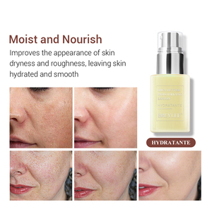 BREYLEE beurre de karité lotion pour le visage hydratant visage - Product Image 4