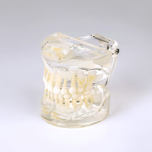 Modèle de dent standard pour bébé / Modèle anatomique avec dentition mixte - Product Image 1