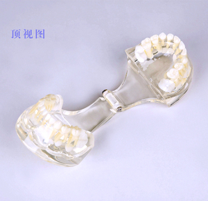 Modèle de dent standard pour bébé / Modèle anatomique avec dentition mixte - Product Image 6