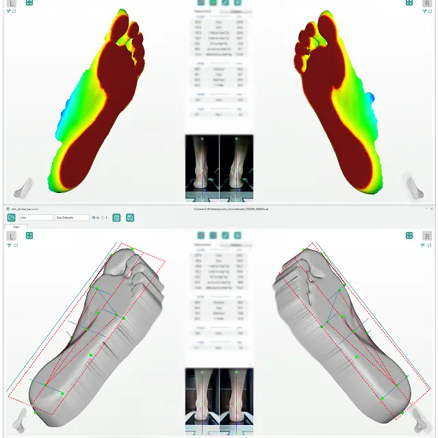 3d 스캐너의 발 화분 스캔