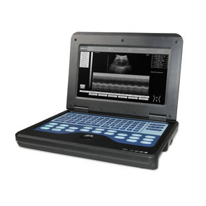 CONTEC Sertifikasi CMS600P2 Pemindai Ultrasound Laptop Digital 10.1 Inci