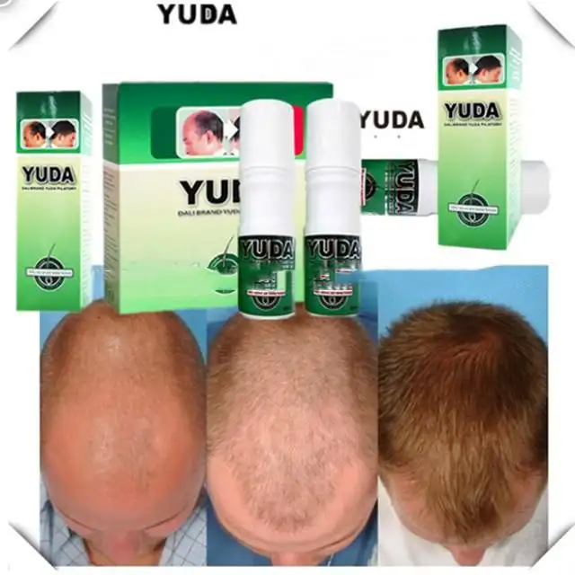 강력한 100% 작업 안티 탈모 스프레이 자신의 브랜드 YUDA buy_hair_loss_treatment