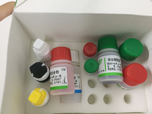 Diagnóstico de aparatos de antígeno de superficie del Virus de la <span class=keywords><strong>Hepatitis</strong></span> <span class=keywords><strong>B</strong></span> Kit de diagnóstico de la prueba de ELISA - Product Image 2