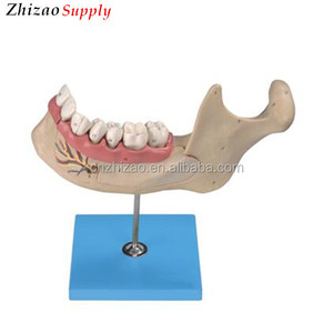 <span class=keywords><strong>2</strong></span>,5 <span class=keywords><strong>veces</strong></span> ampliada modelo dentición, extraíble dientes dentales modelo - Product Image 1