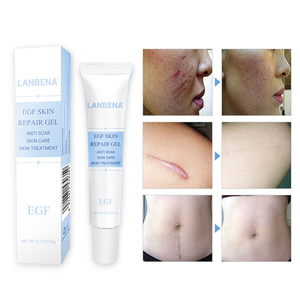 LANBENA FEAG la leche blanca de la cicatriz eliminación crema - Product Image 4