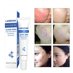 LANBENA cara contra ance grano de piel de luz blanqueamiento gel para las mujeres - Product Image 4