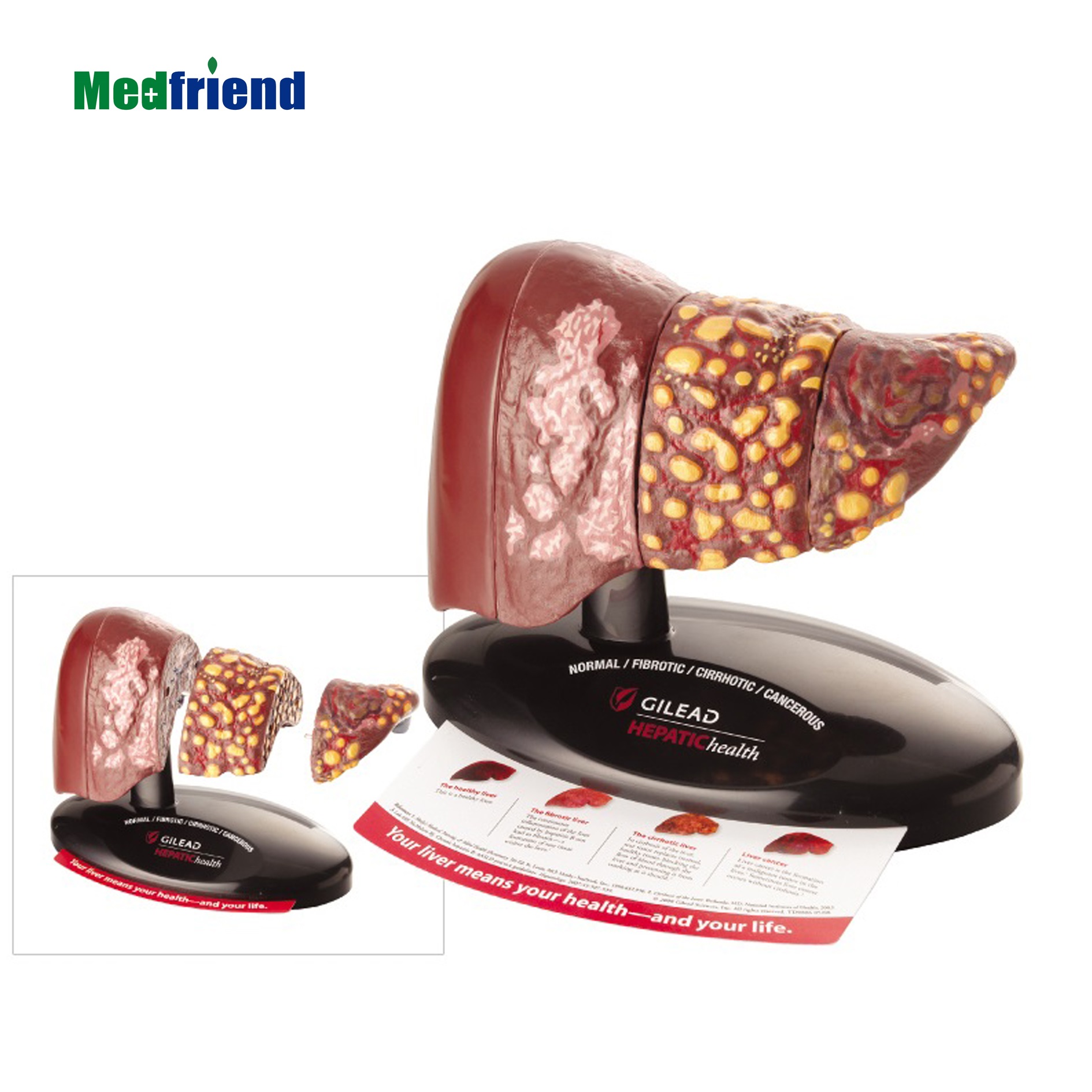 Цена по прейскуранту завода-изготовителя передовые 4-х ступенчатый модель печени