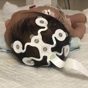 Greentek Headset Elektroda EEG Sekali Pakai Sekali Pakai Pra-gel untuk Neonates Di Unit Perawatan Intensif Neonatal (NICU) - Product Image 5