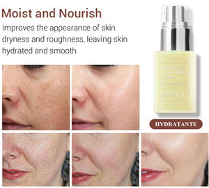 BREYLEE mejor manteca de karité cara crema hidratante loción para - Product Image 5