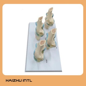 4 Delen Menselijk Plastic Ziek Knieskeletmodel, 4-traps Menselijk Kniegewrichtsmodel - Product Image 2