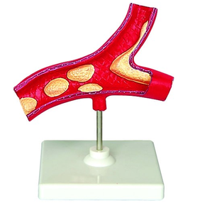 GelsonLab HSBM-231 100X arteria humano modelo <span class=keywords><strong>ganglios</strong></span> <span class=keywords><strong>linfáticos</strong></span> modelo - Product Image 1