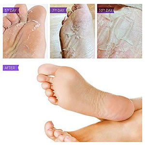 En <span class=keywords><strong>gros</strong></span> Corée Pieds Peeling Masque, Hydratant pour <span class=keywords><strong>les</strong></span> Pieds Masque - Product Image 4