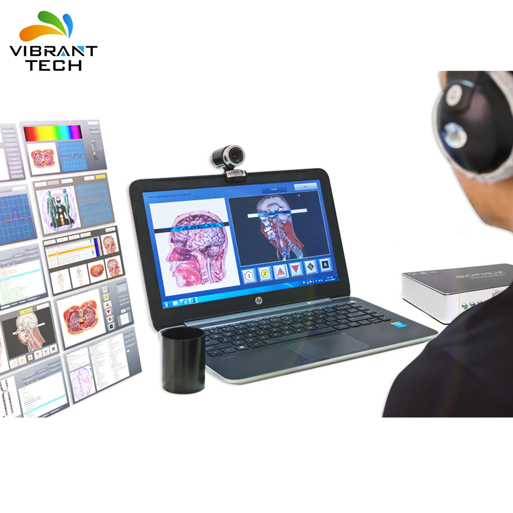 Vector 17 Bioresonance software scanner LRIs 4D scan Bio Health Analyzer