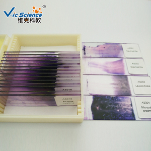 顕微鏡で準備されたスライド血液人間の病理学スライド血液学の病理学スミアーで準備されたスライド医学の病理学