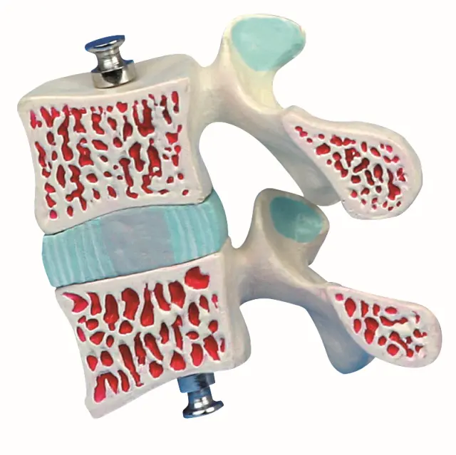 GelsonLab HSMB-138 กระดูกสันหลัง Anatomical Model,พรุนชุด,ntervertebral แผ่นของมนุษย์กระดูกเอวกระดูกปวดรุ่น