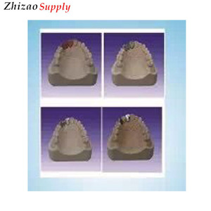 Oral modelo Dental producir pasos de Marilan puente - Product Image 1