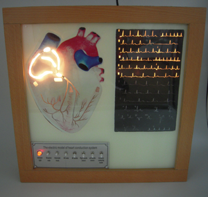 GelsonLab HSEM-001 High Quality Electric the Cardiac Conduction System Model - Product Image 4