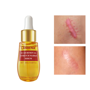 LANBENA d'origine vergetures enlèvement sérum pour cicatrice d'acné - Product Image 2