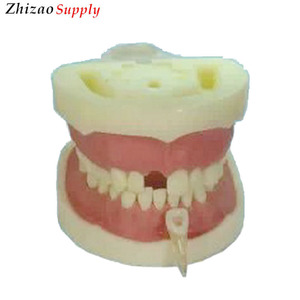<span class=keywords><strong>Les</strong></span> élèves pratiquent dents modèle de canal radiculaire dentaire modèle de canal radiculaire - Product Image 1