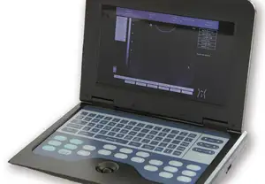 CONTEC CMS600P2 Mesin <span class=keywords><strong>Ultrasound</strong></span>, Alat <span class=keywords><strong>Ultrasound</strong></span> Doppler Portabel Tiongkok - Product Image 3