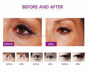 Uso en casa de debajo de los ojos círculo oscuro cuidado de los ojos de los poros de apriete de la máquina de la belleza - Product Image 3