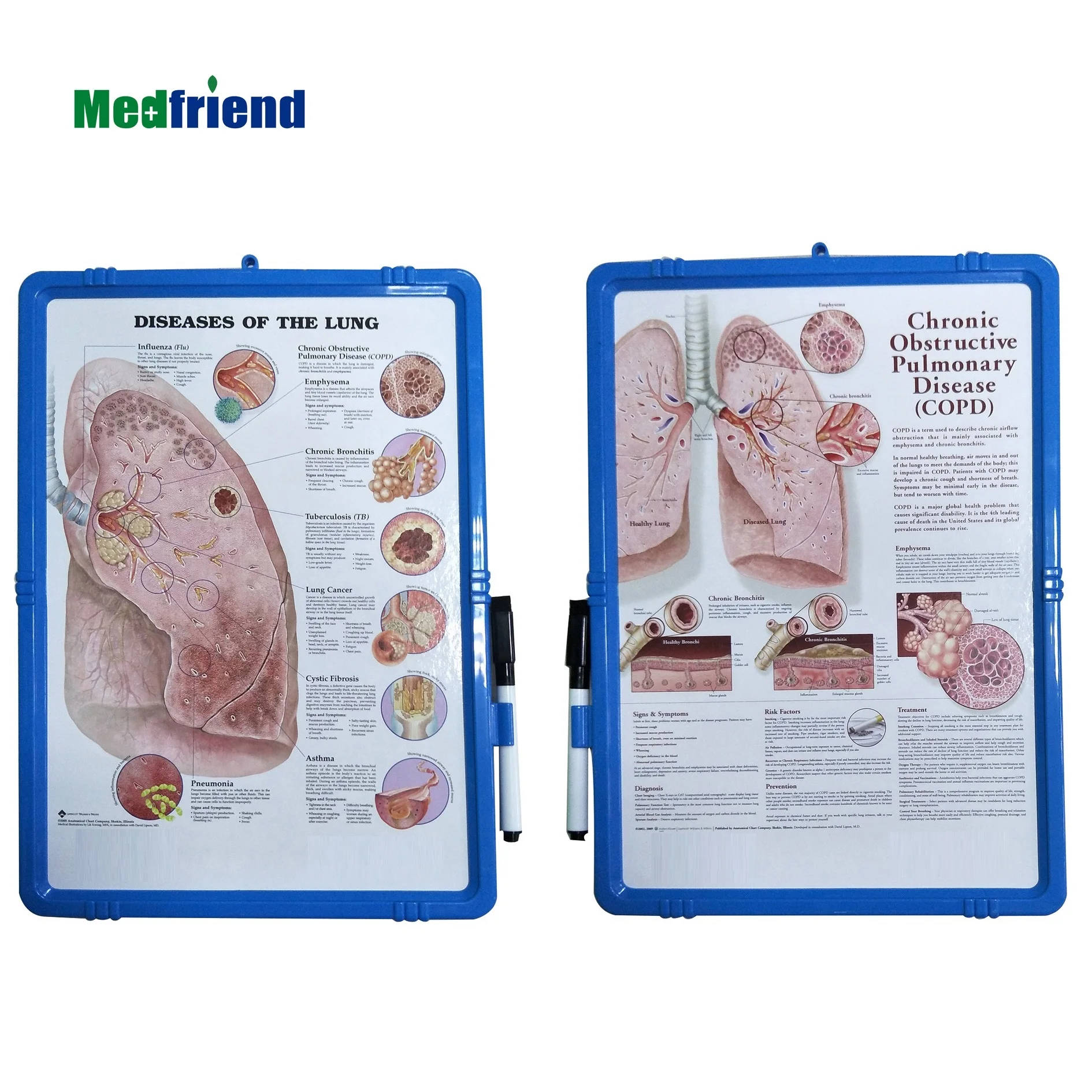 Настольный медицинский мольберт, анатомическая доска с диаграммой Тема: диэсаз легких, ХОБЛ, много дизайнов в наличии