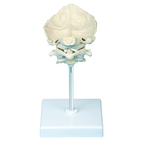 Gelsonlab HSBM-143 Atlas Sumbu dan Occipital Bone Model - Product Image 1