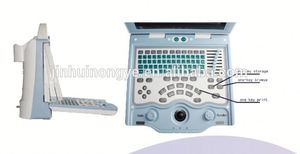 <span class=keywords><strong>Animal</strong></span> equipo de diagnóstico veterinario clínica portable ultrasound scanner - Product Image 3
