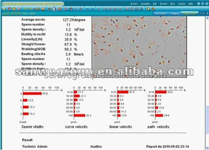 Sanwe SW-<span class=keywords><strong>3702</strong></span> Analisador da Qualidade do Esperma com câmara de contagem de esperma - Product Image 5