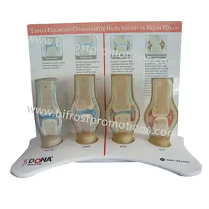 Anatomical Model Medical Anatomical Pathological Knee Joint Model