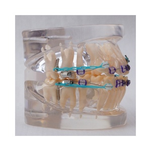 Dentale Ortodontico modello Con staffa di ceramica - Product Image 5