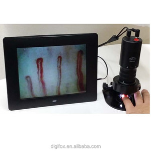DMX980-1 Biological <b>Microscope</b> Microcirculation - Product Image 1