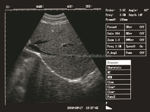 Instrumen Ultrasound Medis Hitam dan Putih, Perangkat Pemindai Ultrasound Genggam Portabel dengan <span class=keywords><strong>Probe</strong></span> untuk Dokter Hewan atau Manusia - Product Image 2