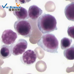 Chuẩn bị Slide máu smear Slide kính hiển vi chuẩn bị huyết học máu smear Slide - Product Image 3