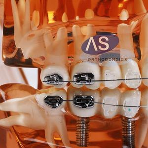 <span class=keywords><strong>022</strong></span> ortodontik bukkal tüp - Product Image 4