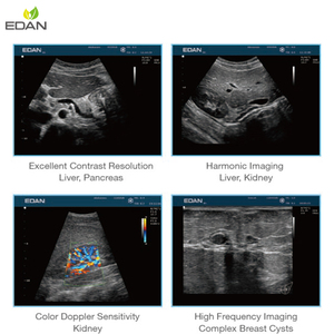 Troli USG <span class=keywords><strong>Edan</strong></span> U2 dengan 4 Konektor Transduser Sistem USG Doppler Warna Aktif - Product Image 4