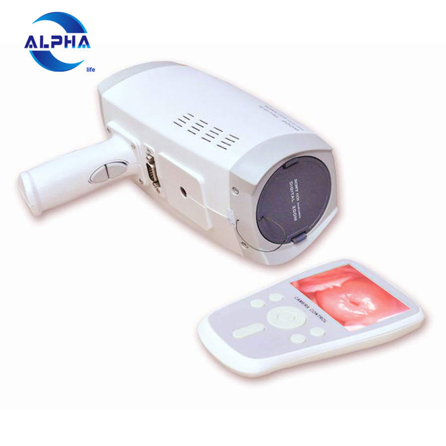 Цифровая камера sony colposcope для гинекологии