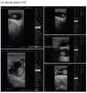 Peralatan Perusahaan/Pabrik untuk Dijual Peralatan <span class=keywords><strong>Ultrasound</strong></span> Veteriner V10 PLUS di Beijing - Product Image 2
