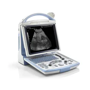 Mindray Dp 10 Draagbare Ultrasound Machine Prijs