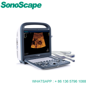 <span class=keywords><strong>Sonoscape</strong></span> <span class=keywords><strong>S2</strong></span> Portable <span class=keywords><strong>Sonoscape</strong></span> Usg Color Doppler Usg - Product Image 4
