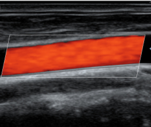 Preço da máquina de ultra-sonografia <span class=keywords><strong>Mindray</strong></span> <span class=keywords><strong>dc</strong></span> 30/trolly carrinho - Product Image 2