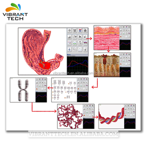 De Verificação de Saúde e Terapia bioressonância 25 3DNLS Metatron <span class=keywords><strong>Hunter</strong></span> <span class=keywords><strong>4025</strong></span> - Product Image 5